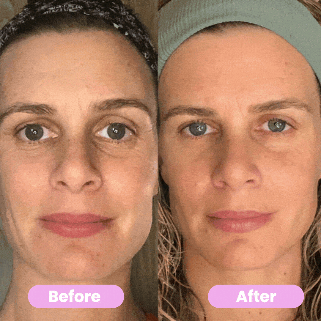 Valara Facelift Wand